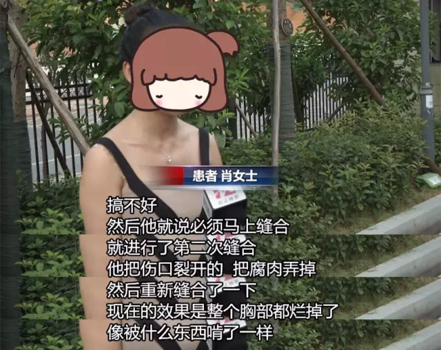 女子花近十萬做豐胸手術 術后胸部潰爛似被啃