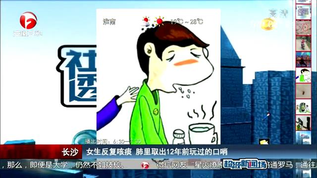 女生反復咳痰 肺里取出12年前玩過的口哨