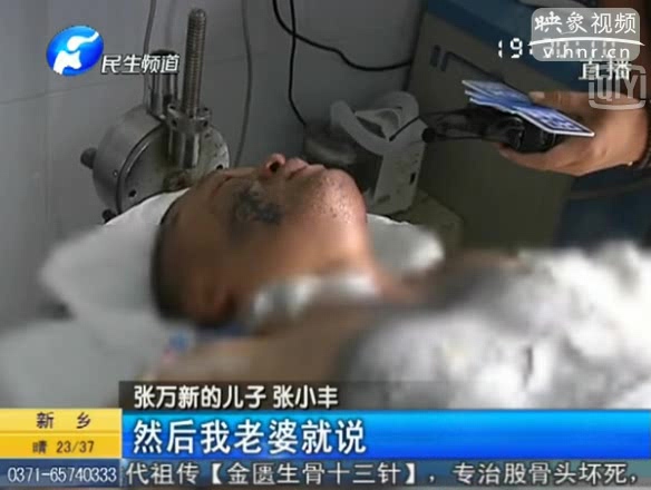 男子腿疼酒精擦拭后打火機烘干 重度燒傷